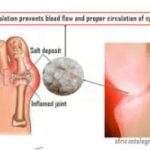 Best Treatment for Joint Pain Is Arthrazex Balm— Dr. Mataji Havaldar Reveals